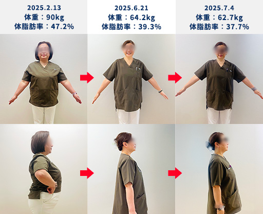 50代女性の症例